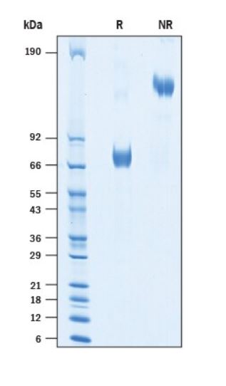 2 μg/lane Protein  was resolved with SDS-PAGE under reducing (R) and non-reducing (NR) conditions and visualized by Coomassie® Blue staining.